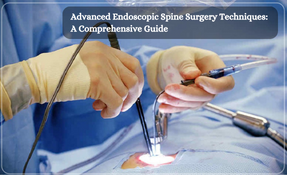 Advanced Endoscopic Spine Surgery Techniques: A Comprehensive Guide